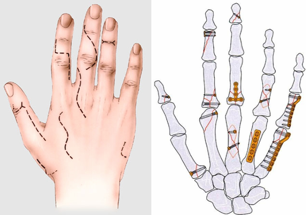 Teste dos dedos revela se você nasceu para ter franja: especialista em imagem ensina